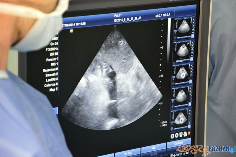 Certus - nanoknife Foto: mat.prasowe Certus - nanoknife Foto: mat.prasowe