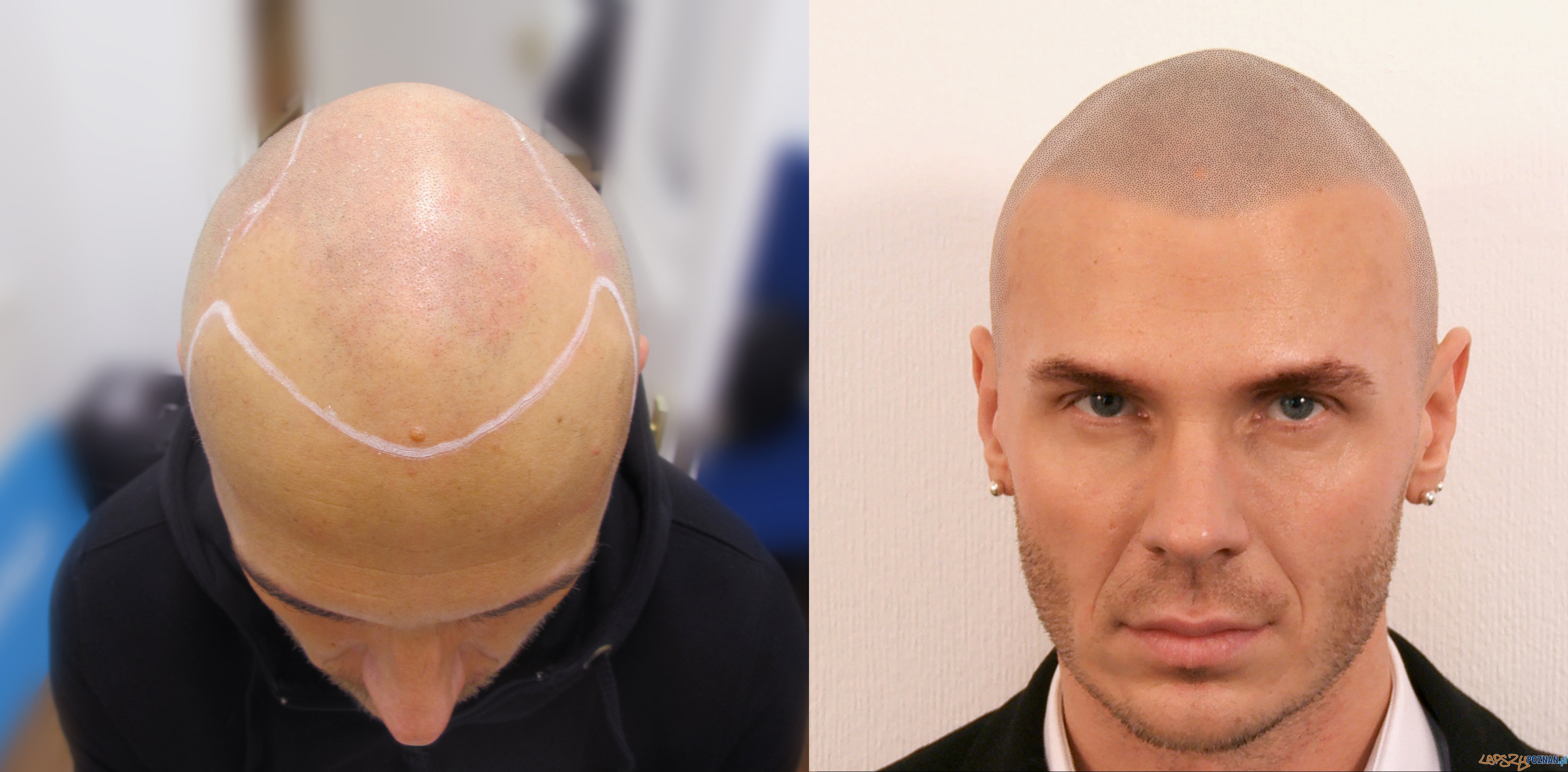 Before & After  Foto: 