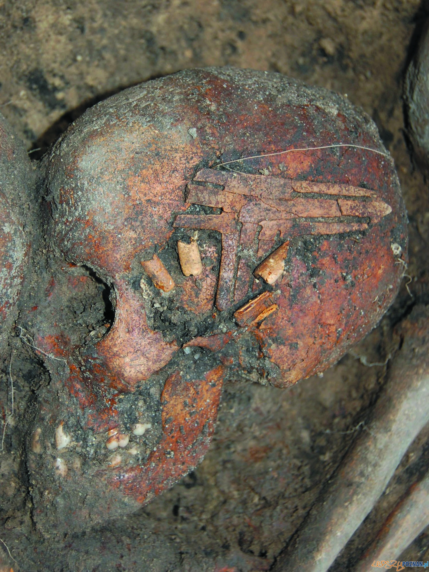 Czaszka z grobu w Koszycach Foto: M.M.Przybyła Czaszka z grobu w Koszycach Foto: M.M.Przybyła