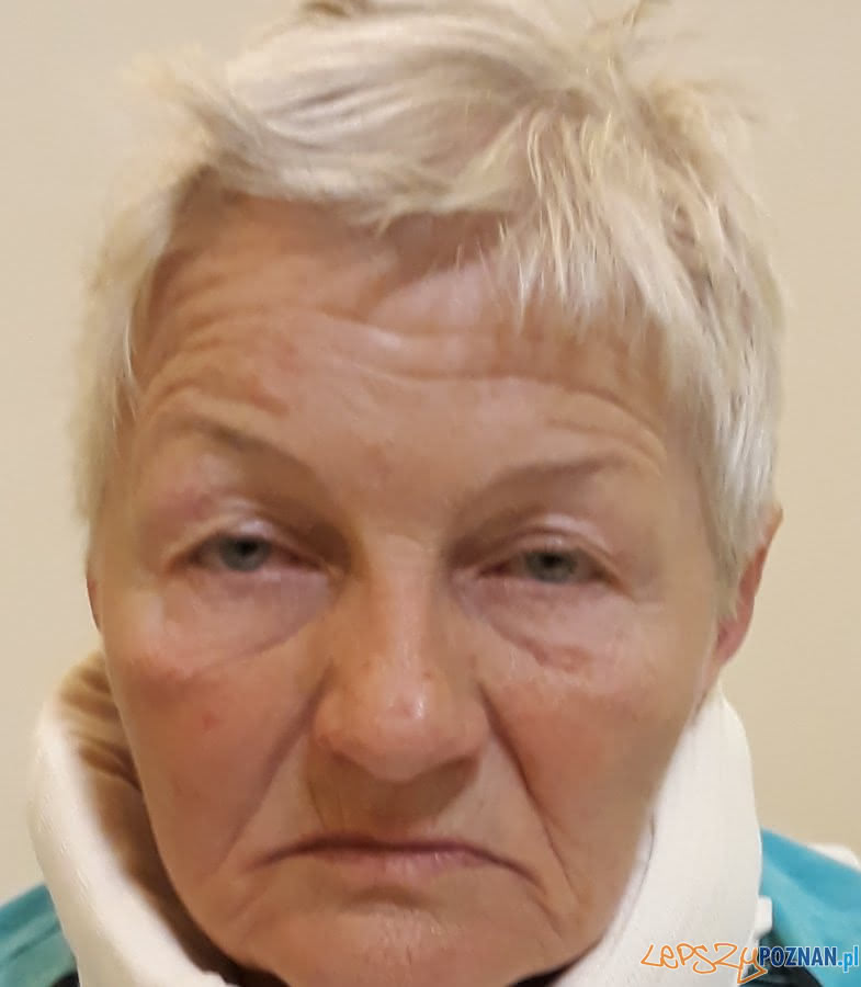 Kobieta spotkana w parku Wilsona - nie pamięta kim jest Foto: Kobieta spotkana w parku Wilsona - nie pamięta kim jest Foto: