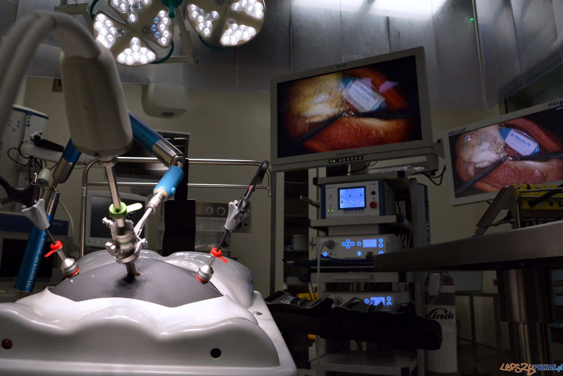 Szpitala Klinicznego im. Karola Jonschera Uniwersytetu Medycznego w Poznaniu Foto: mteriały prasowe / UMP Szpitala Klinicznego im. Karola Jonschera Uniwersytetu Medycznego w Poznaniu Foto: mteriały prasowe / UMP