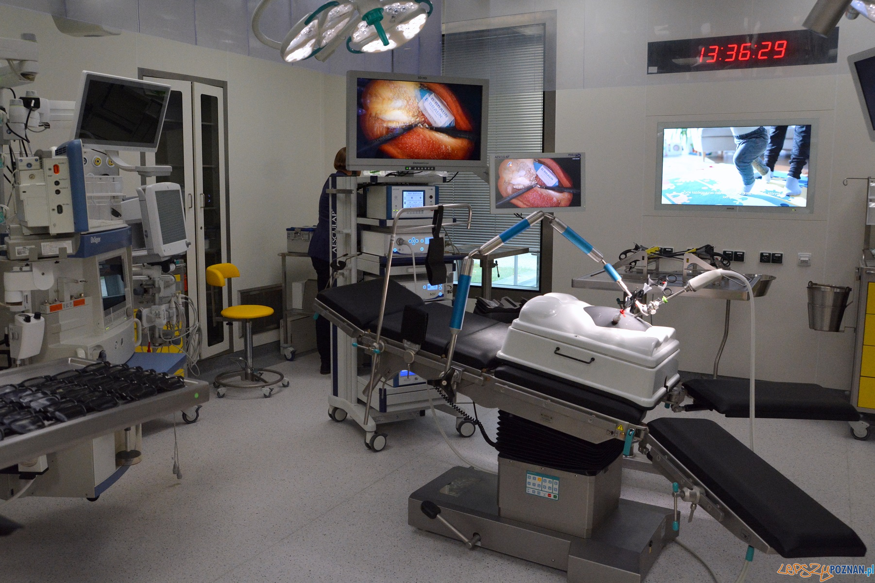 Szpitala Klinicznego im. Karola Jonschera Uniwersytetu Medycznego w Poznaniu Foto: mteriały prasowe / UMP Szpitala Klinicznego im. Karola Jonschera Uniwersytetu Medycznego w Poznaniu Foto: mteriały prasowe / UMP